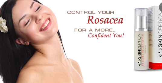 How Can Rosacea Relief Serum Help You?