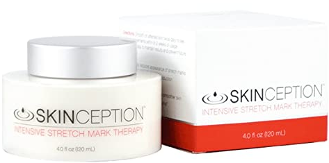 What is Skinception Cream and How it will help Women with Stretchmarks